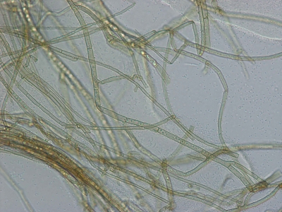 Rhizoctonia sp. micēlijs